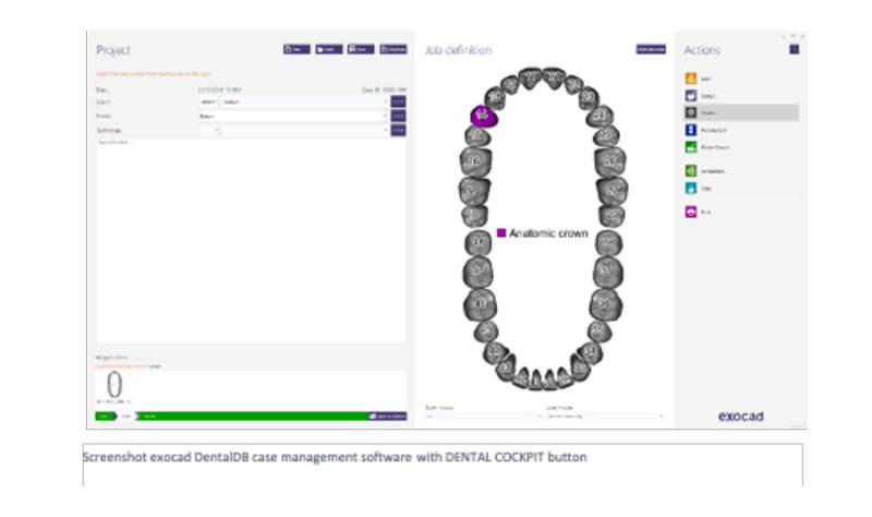 Stampa 3D per odontotecnici