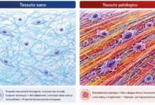 Fig 1. Confronto schematico tra tessuto sano e tessuto patologico. Nel tessuto sano, proprietà meccaniche fisiologiche e un rimodellamento controllato della matrice extracellulare contribuiscono alla normale funzione del tessuto. Nei tessuti patologici, come tumori e fibrosi, il rimodellamento della matrice, il cross-linking e l’allineamento delle fibre di collagene sono associati a un aumento della rigidità e ad alterazioni della funzione tissutale.