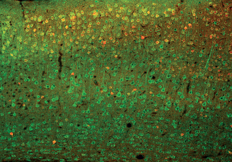 I sistemi di posizionamento verticale sono richiesti in numerose applicazioni sia nel campo della microscopia che dell’industria. I sistemi di posizionamento verticale sono richiesti in numerose applicazioni sia nel campo della microscopia che dell’industria.