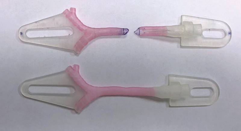 Modelli stampati in 3D che mostrano la pianificazione chirurgica virtuale per una procedura di tracheoplastica.