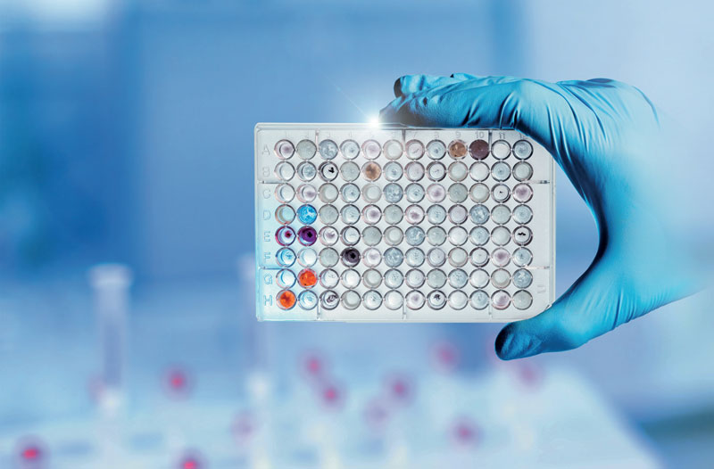 a molti anni le soluzioni automatizzate sono indispensabili nella cosiddetta diagnostica in vitro (IVD),