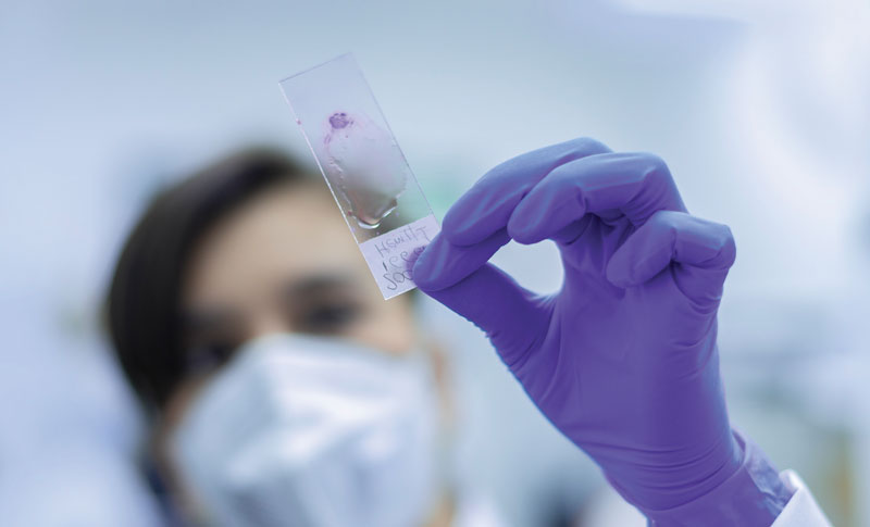 ALIO è all’avanguardia nelle soluzioni di controllo del movimento per la patologia digitale