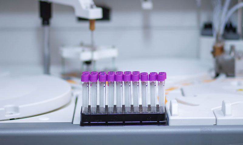 L’azienda tedesca Jung Antriebstechnik u. Automation si rivolge all’industria farmaceutica, al settore delle analisi e della tecnologia medica con soluzioni di automazione piccole, ma funzionali.