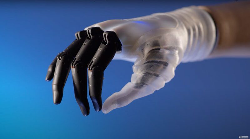 Hannes è il nome della mano protesica sviluppata dall’istituto Italiano di tecnologia, con il contributo di MICROingranaggi.